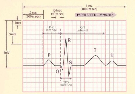 Tìm hiểu dạng sóng ECG